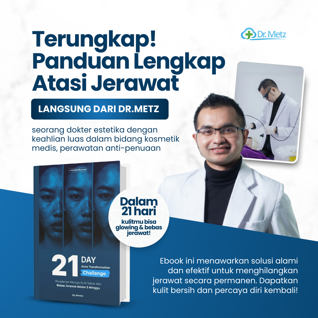 21 Hari Bebas Jerawat